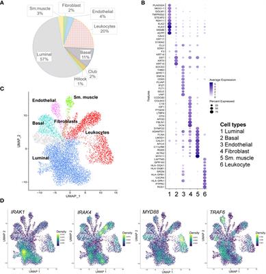 Interleukin-1 receptor associated kinase 1 (IRAK1) is epigenetically activated in luminal epithelial cells in prostate cancer